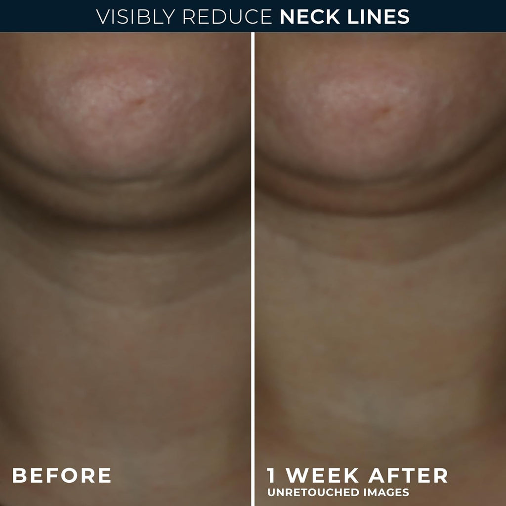 RoC Derm Correxion Neck Cream with Hyaluronic Acid + Advanced Retinol to visibly Tighten & Lift Horizontal Neck Lines, Facial Moisturizer to Contour Face (1.7 oz) with RoC Retinol Eye Packette