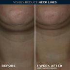 RoC Derm Correxion Neck Cream with Hyaluronic Acid + Advanced Retinol to visibly Tighten & Lift Horizontal Neck Lines, Facial Moisturizer to Contour Face (1.7 oz) with RoC Retinol Eye Packette
