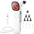 ScopeAround Digital Otoscope w/Built-in Screen, Manual-Focus Digital Otoscope with Light for Home Use, No App Needed, Easy Viewing for Everyday Ear Checks, Otoscope Camera, White