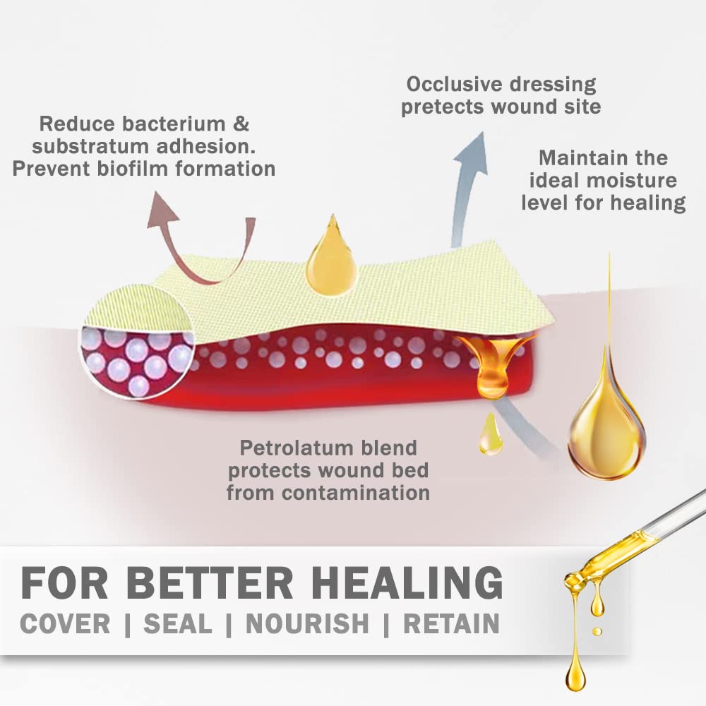 EVERLIT Xeroform Petrolatum Dressing | Sterile, Non-Adherent Occlusive Fine Mesh Gauze Pad | Non-Toxic, Gentle Patch for Burns, Laceration, Surgical Incisions & Skin Grafts (1" x 8" | Pack of 50)