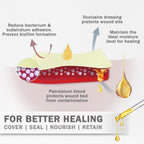 EVERLIT Xeroform Petrolatum Dressing | Sterile, Non-Adherent Occlusive Fine Mesh Gauze Pad | Non-Toxic, Gentle Patch for Burns, Laceration, Surgical Incisions & Skin Grafts (1" x 8" | Pack of 50)