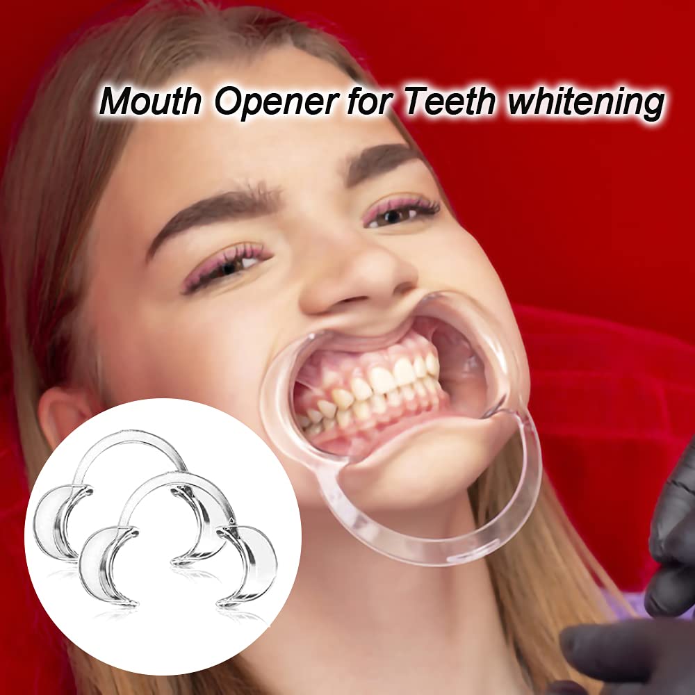 100-Pack Dental Cheek Retractor, Professional Autoclavable Mouth Opener Retractors, 100% BPA-Free, for Dentist, Teeth Whitening, Party, Mouthguard Challenge Game - Size M, Clear