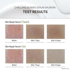 [CHALLANS de PARIS] Ampoule d’Aurora Excellence – Soothing & Balancing Skin-Barrier Support Serum with Niacinamide, Oligo-HA & Ceramide | Lightweight Watery, Hydrating Korean Skincare, 1.23 fl oz