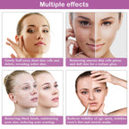 Diamond Microdermabrasion Machine, Yofuly 65-68cmHg Suction Power Professional Dermabrasion, Home Use Facial Skin Care Equipment