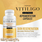 Dermawonder Vitiligo Capsules (60 Count) Effective Vitiligo Supplement, Reduce White Spots & Improve Skin Pigmentation Support, for All Skin & Reduce White Spots on Skin and Tinted Skin