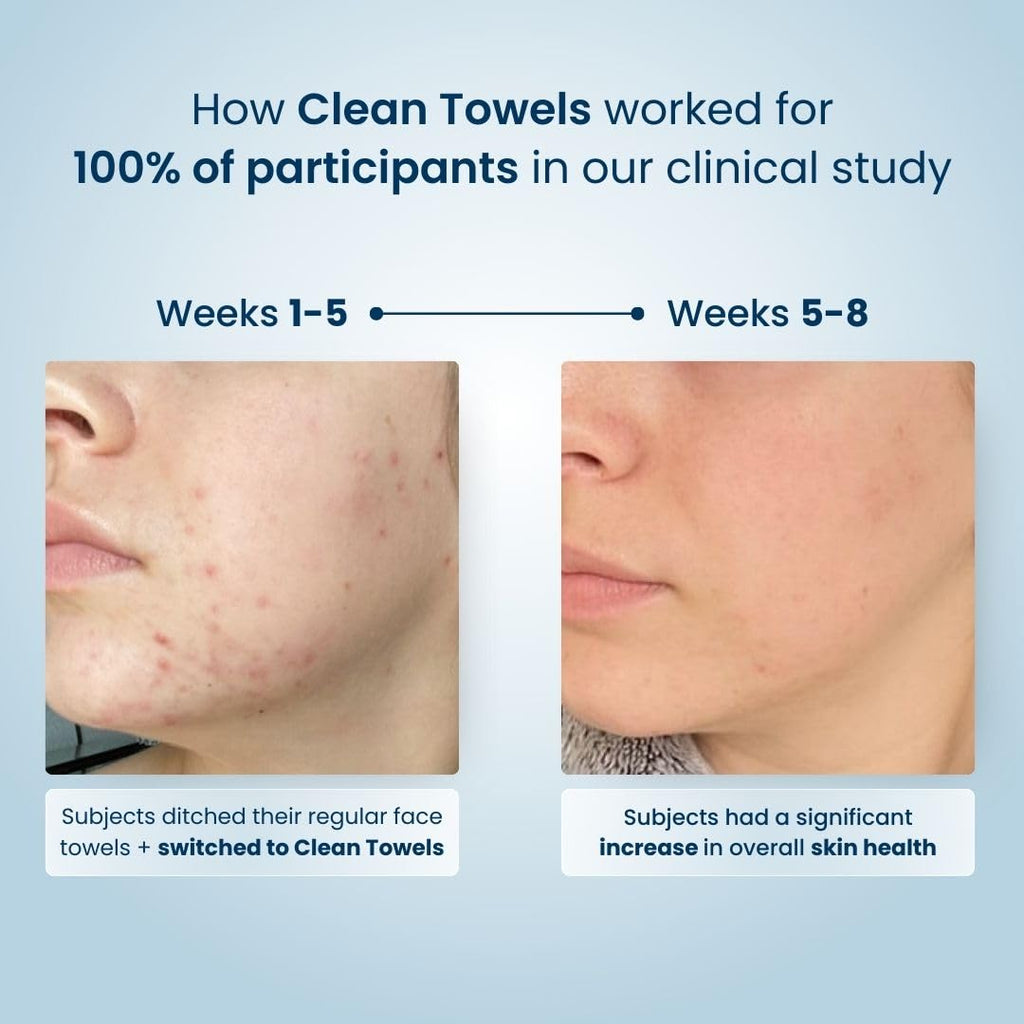 Clean Skin Club Clean Towels XL™, 100% USDA Biobased Face Towel, Disposable Face Towelette, Eczema Association Accepted, Makeup Remover Dry Wipes, Ultra Soft (30 Count (Pack of 3))