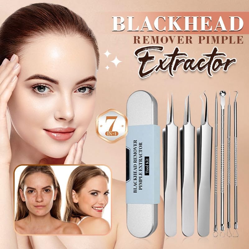 Medical Grade Blackhead Extraction Tool Kit - Blackhead Remover Tool Comedones Extractor Acne Removal Kit for Blemish - Whitehead Popping - 7 Pcs Set Removing for Nose Face Tools (Content 7-Piece Set)
