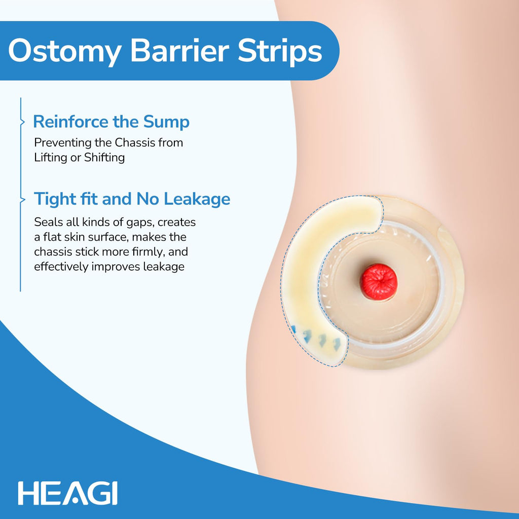 Heagimed 20PCS Ostomy Barrier Strips, Skin-Friendly Hydrocolloid Skin Barrier Strips, Elastic Barrier Strips for Ostomy Bag Ostomy Colostomy Ileostomy Supplies