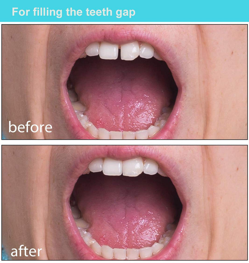 Brige Temporary Tooth Repair Missing Tooth- Moldable Fake Teeth Artfifical Teeth,Cosmetic Tooth Replacement Kit for Teeth Veneers