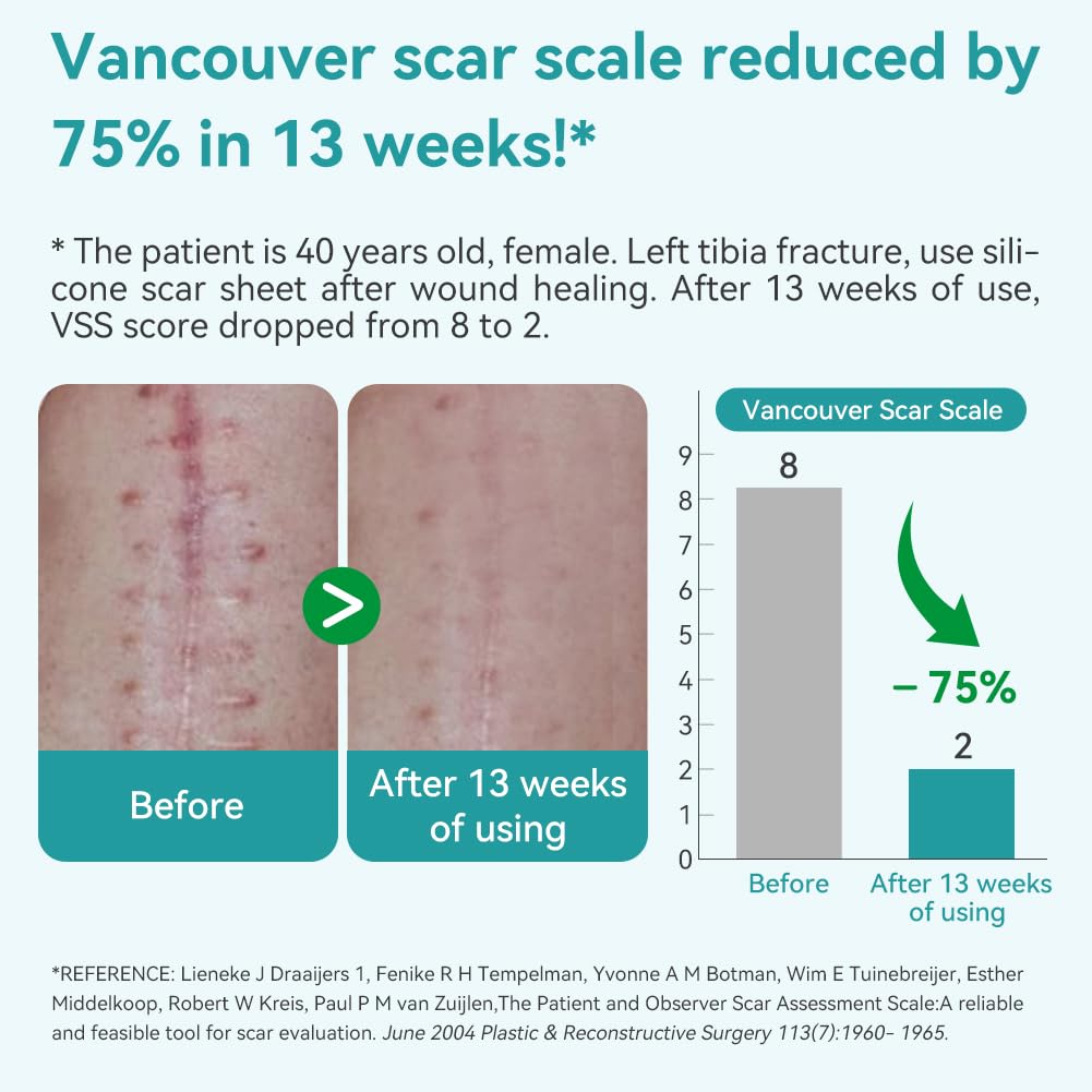 Dimora Medical Grade Silicone Scar Sheets - Ultra Soft Silicone Scar Tape (1.6”x120" Roll), Waterproof Scar Treatment for Surgical Scars, C Section, Tummy Tuck, Keloid Treatment