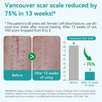 Dimora Medical Grade Silicone Scar Sheets - Ultra Soft Silicone Scar Tape (1.6”x120" Roll), Waterproof Scar Treatment for Surgical Scars, C Section, Tummy Tuck, Keloid Treatment