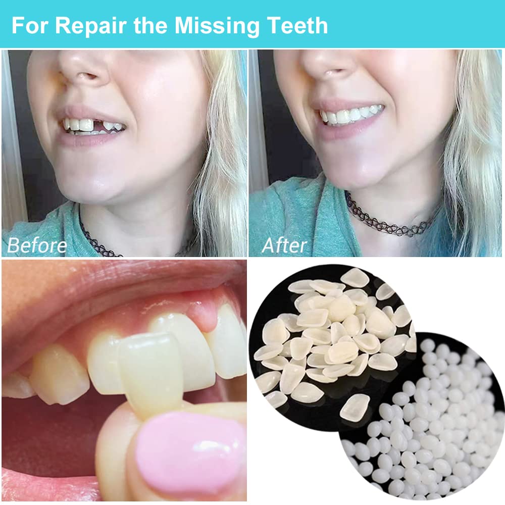 Brige Temporary Tooth Repair Missing Tooth- Moldable Fake Teeth Artfifical Teeth,Cosmetic Tooth Replacement Kit for Teeth Veneers