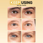 8 Pairs 5% PDRN Under Eye Patches, 6-in-1 Bio-Collagen 360° Eye Patches for puffy eyes, dark circles & Wrinkle | 2% Caffeine, Kojic acid, Retinol, Hyaluronic, Niacinamide | Korean Eye Care