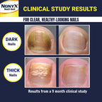 NONYX Fungal Nail Clarifying Gel | Clinically Proven for Discolored, Thick, Brittle, Yellow, Lifted, and other signs of Fungus-Damaged Toenails | 90% of Nails Improve | Over 8 million sold
