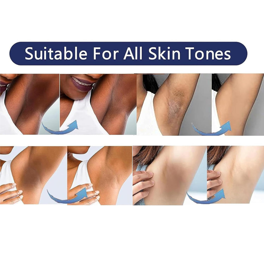 Skin Bleaching Cream Skin Lightening for Body Intimate Areas, Private Parts, Underarm, Knees, Elbows, Inner Thigh, Bikini Area, Whitening Cream Dark Spot Remover For Intimate Areas (1.7FL OZ)