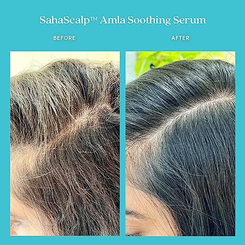 Fable & Mane Amla Soothing Serum with Rosemary Oil Purifies and Balances Irritation. Detox Treatment for Dry, Itchy or Sensitive Scalps (1.8 fl oz / 55ml)