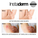 Vitamin K Cream-Revitalizing Formula with Arnica for the Appearance of Brusing, Spider Veins, Broken Capillaries, Uneven Tone & Dark Spot – Under Eye Cream for the Look of Dark Circles & Puffiness