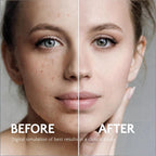 Rivocoda Hydraquinonol Dark Spot Brightening Cream - 4% Bleaching Cream, Non-Irritating Hydrating, For All Skin Types, 1oz