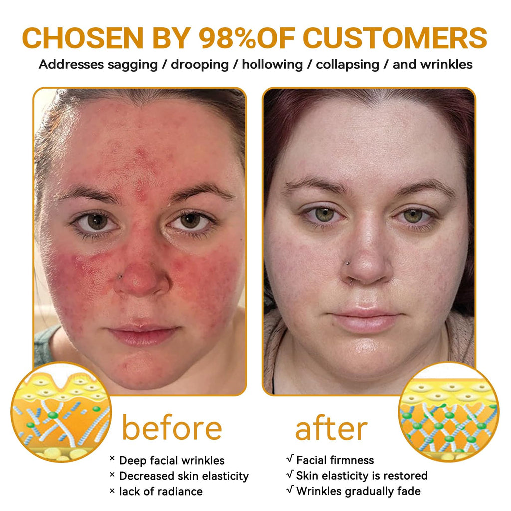 BeeRx Bee Venom Skin Treatment Cream, Professional Bee Venom Cream, BeeRx Anti Aging Serum, Repair,Reducing The Appearance of Blemishes, Natural Ingredients for All Skin Types (2 Bottle)