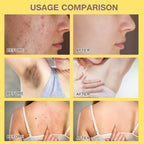 2 Pcs Bee Venom Cream, New Professional Bee Venom Skin Treatment Cream for All Parts of The Body (2.12oz)