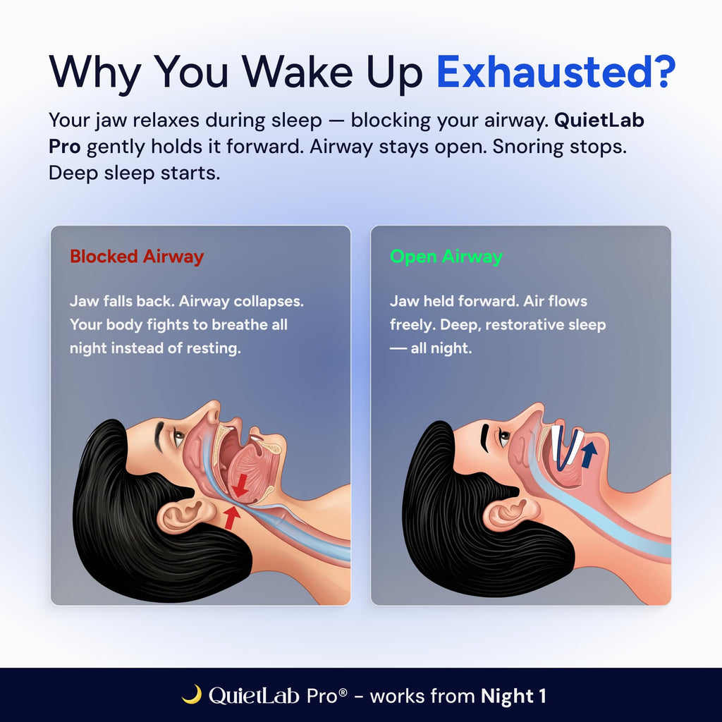QuietLab Pro Anti-Snoring Mouthpiece - Adjustable Snoring Mouth Guard, Orthodontist Designed, No Boiling Required - BPA-Free Medical Grade - Designed for Nighttime Snoring Control