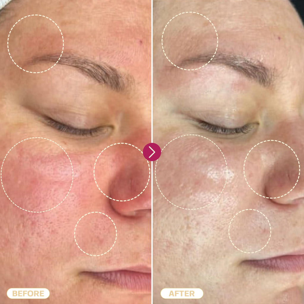 "BASE LABORATORIES Hypochlorous Acid Spray for Skin & Face | Healing HOCL Molecule Spray | for Wounds, Irritations, Redness, Facial Cleanser, Acne & Eczema Treatment | 240ml"