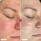 "BASE LABORATORIES Hypochlorous Acid Spray for Skin & Face | Healing HOCL Molecule Spray | for Wounds, Irritations, Redness, Facial Cleanser, Acne & Eczema Treatment | 240ml"