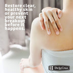 De La Cruz Sulfur Ointment - Cystic Acne Treatment for Face and Body - Daily 10 Min Spot Treatment Mask - Safe and Effective Game Changing Hormonal Acne Treatment That Clears Up Pimples 5.5 OZ.
