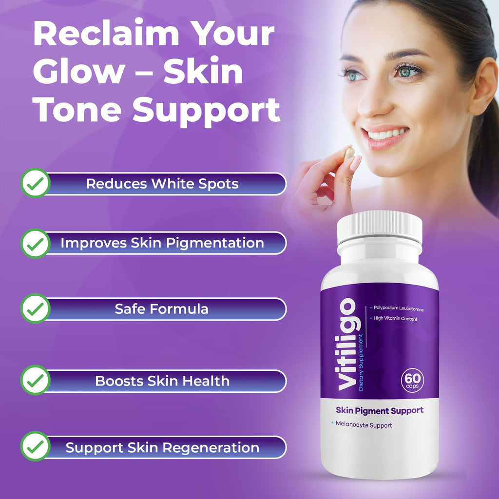 AURA VITAMINS - Vitiligo Capsules 60 Count | 1 Month | Improve Skin Pigmentation Support and Reduce White Spots | Effective Vitiligo Supplement | Natural Solution for White Spots on Skin. (1)