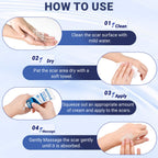 Kunyle Scar Cream, Silicone Scar Gel, Advanced Scar Removal Cream for Surgical Scars, Stretch Marks Removal, Keloid Bump Removal, Old and New Scars 2.11 Oz (60g)