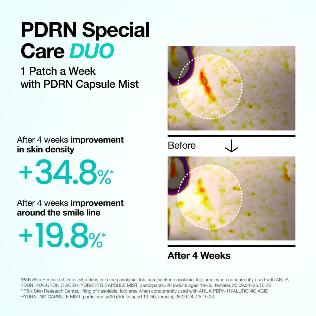Anua Salmon DNA PDRN Collagen Melting Patch for Glass skin, Smile Line Patches, Wrinkle Patches, Melting Thin Collagen Patch, Firming for Fine Lines, Glow, Hydrating, Korean Skincare, 2 Pairs x 4EA