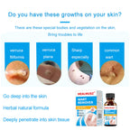 Skin-Tag-Remover, Wart Remover, Mole & Wart-Remover Liquid, Fast-Acting Skin-Tag-Remover for Tag Removal & Verruca-Treatment