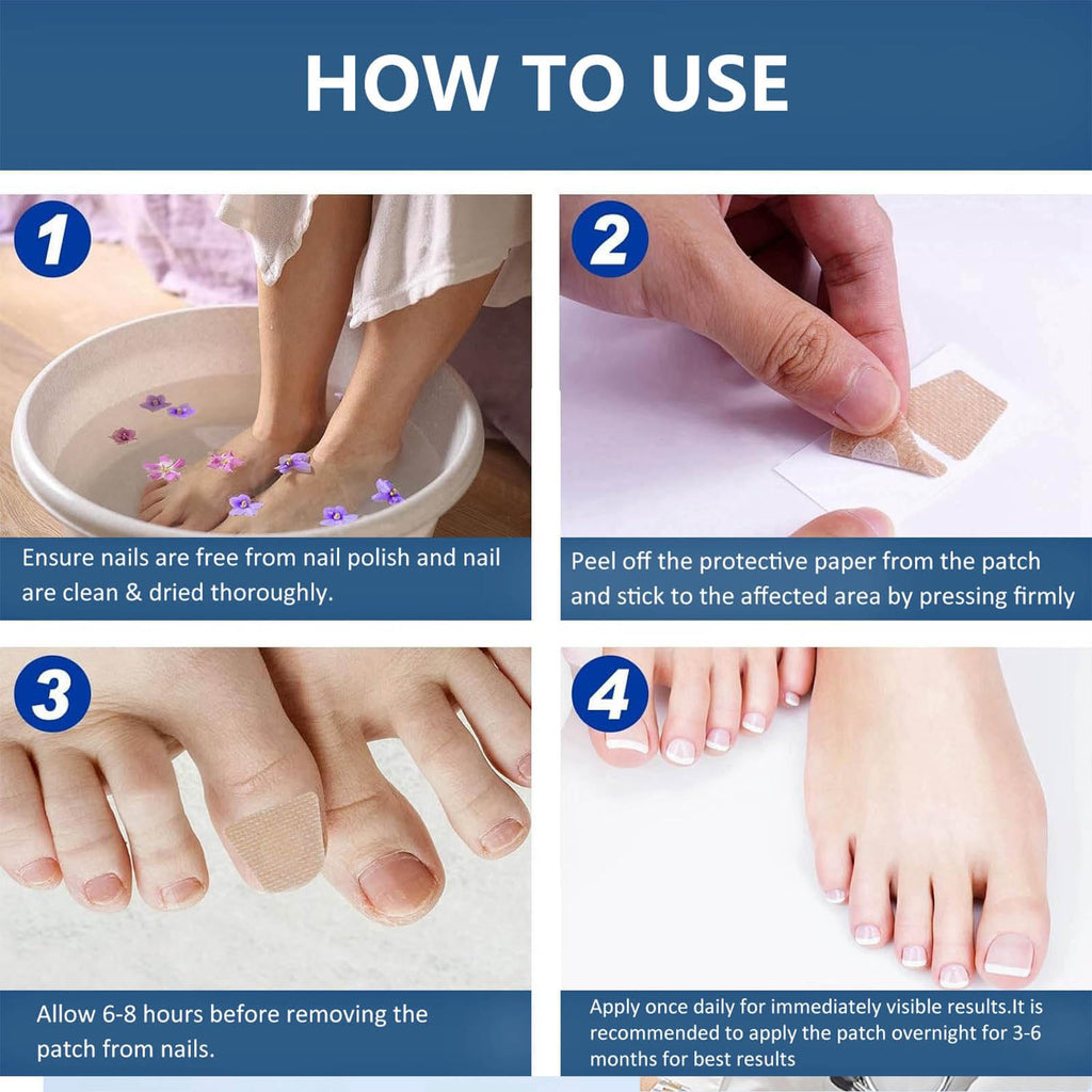 64PCS Fungal Nail Patches, Fungal Nail Treatment for Toenails Extra Strong, Fast-Acting Nail Fungal Treatment Patches for Damaged & Thick Nails, Overnight Repair & Long-Lasting Relief