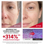 CENTELLIAN 24 Madeca Cream Time Reverse, TECA Moisturizer (2-Pack)