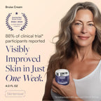 SKINTENSIVE Arnica Bruise Cream for Thin Skin - Moisturizing Arnica Cream, Vitamin K C and E, Skin Renewal, 4 Oz