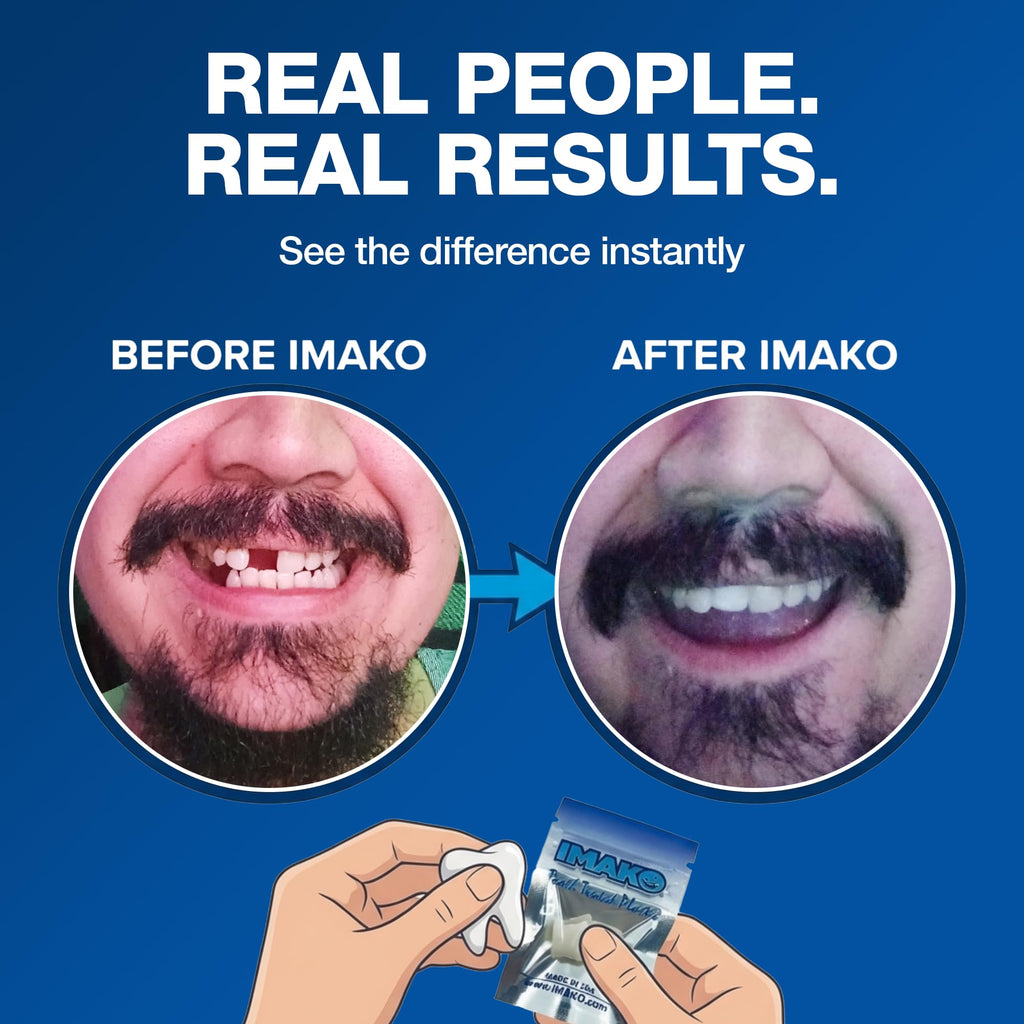 Imako Tooth Tinted Plastic - Natural Color - Temporary Tooth - Made in USA