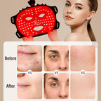 ANGAUSS 7 Color Red Light Therapy Mask, Wireless LED Face Mask Light Therapy with Eye Protection Cushion, Lightweight Soft Silicone Red Light Therapy for Face for Wrinkle Reduction Anti Aging