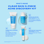 Acne Treatment Trial Kit – Salicylic Acid & Mandelic Acid for Clear Skin – Oil Control, Spot Treatment & Cleanser – Travel Size Skincare for Acne-Prone Skin (3-Piece Clear Skin Kit)