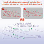 HOMCA Face Down Pillow After BBL or Eye Surgery - Home Massage Pillow Stomach Sleeping Face Down for Bed with CertiPUR-US Certified Memory Foam and Removable Cover