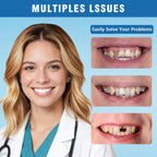 Moldable False Teeth - Silicone Dentures - Men and Veneers Teeth for Women - Upper and Lower Matching Set - Fix Your Smile at Within Minutes - Blue - 1PCS - Y7