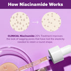 Paula's Choice CLINICAL 20% Niacinamide Vitamin B3 Concentrated Face Serum, Anti-Aging Serum for Face, Treatment for Discoloration & Minimizing Large Pores, Fragrance-Free, 0.67oz