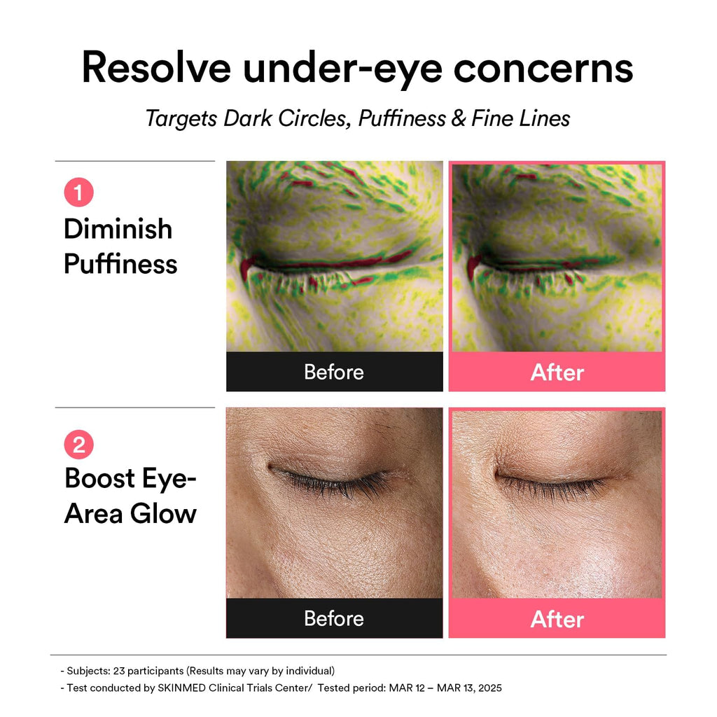 Abib Eye Patch, Hydrogel Masks for Dark Circles, Puffiness, Fine Lines, 60 Patches, 84g, with Niacinamide, K-Beauty Skincare (PDRN Retinal)