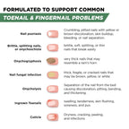 Foot Cure Toenail Fungus Treatment Extra Strength – Athletes Foot Treatment for Toenails, Restorative Nail Repair for Damaged Nails, Toenail Softener with Tea Tree Oil & Oregano Oil - Made in USA