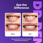 DrDent Professional Teeth Whitening Strips 21 Treatments - Safe for Enamel - Non Sensitive Teeth Whitening - Whitening Without Any Harm - Pack of 42 Strips + Mouth Opener Included