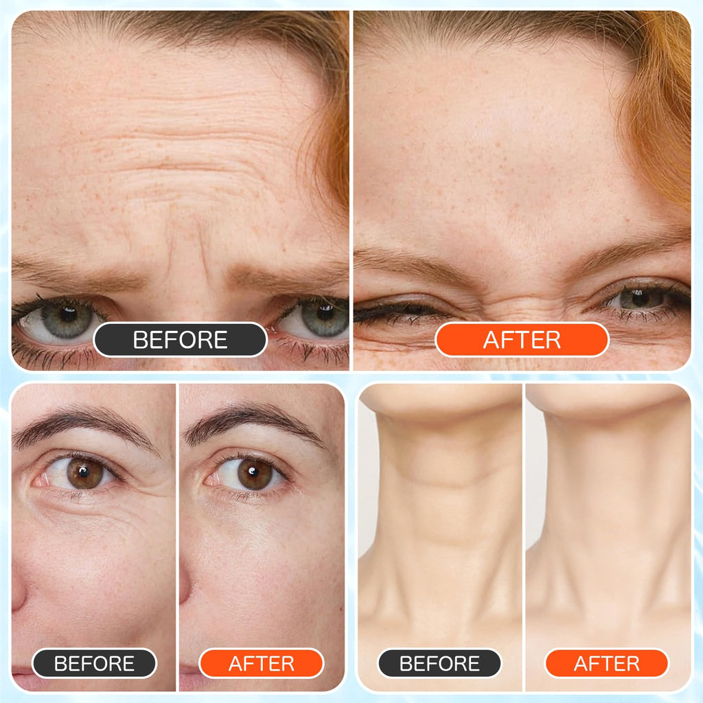 sinBron Forehead Wrinkle Patches 15 PCS - Smooth Fine Lines & Wrinkles, Anti-Wrinkle Patches with Hydrolyzed Collagen with Aloe, for Wrinkle Removal, Firming, Hydrating Skin Care - New Version 6