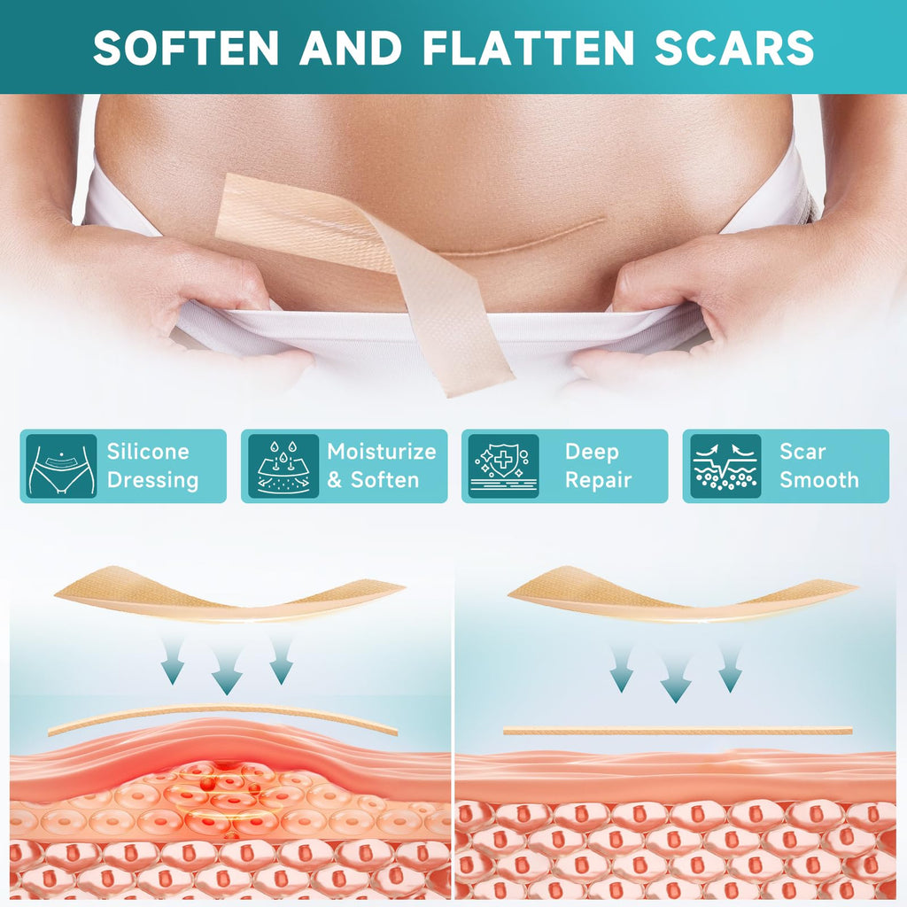 Pumkot Silicone Scar Sheets, Silicone Scar Tape(1.8” x 157” Roll-4M), Medical Grade Scar Removal Away Strips for Surgical Scars, Keloid, C-Section, Burn - Stickiness Upgrade, Waterproof, Reusable