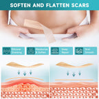 Pumkot Silicone Scar Sheets, Silicone Scar Tape(1.8” x 157” Roll-4M), Medical Grade Scar Removal Away Strips for Surgical Scars, Keloid, C-Section, Burn - Stickiness Upgrade, Waterproof, Reusable