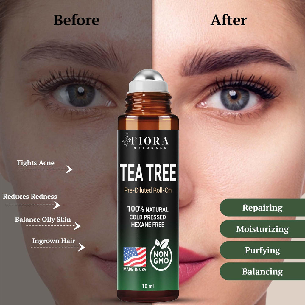 Fiora Naturals Tea Tree Oil Roll On - 100% Natural Tea Tree Essential Oil for Skin, Face, Acne, Nails, Cuticles, Scalp & Aromatherapy Wellness