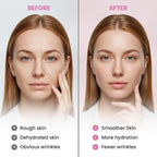 Adellina New Anti Facial Wrinkle Patches: Anti Wrinkle Patches Overnight - Smile Line Pathces - Facial Wrinkle Patche for Forehead, Smile Line, Under Eyes (1 Count (Pack of 144))