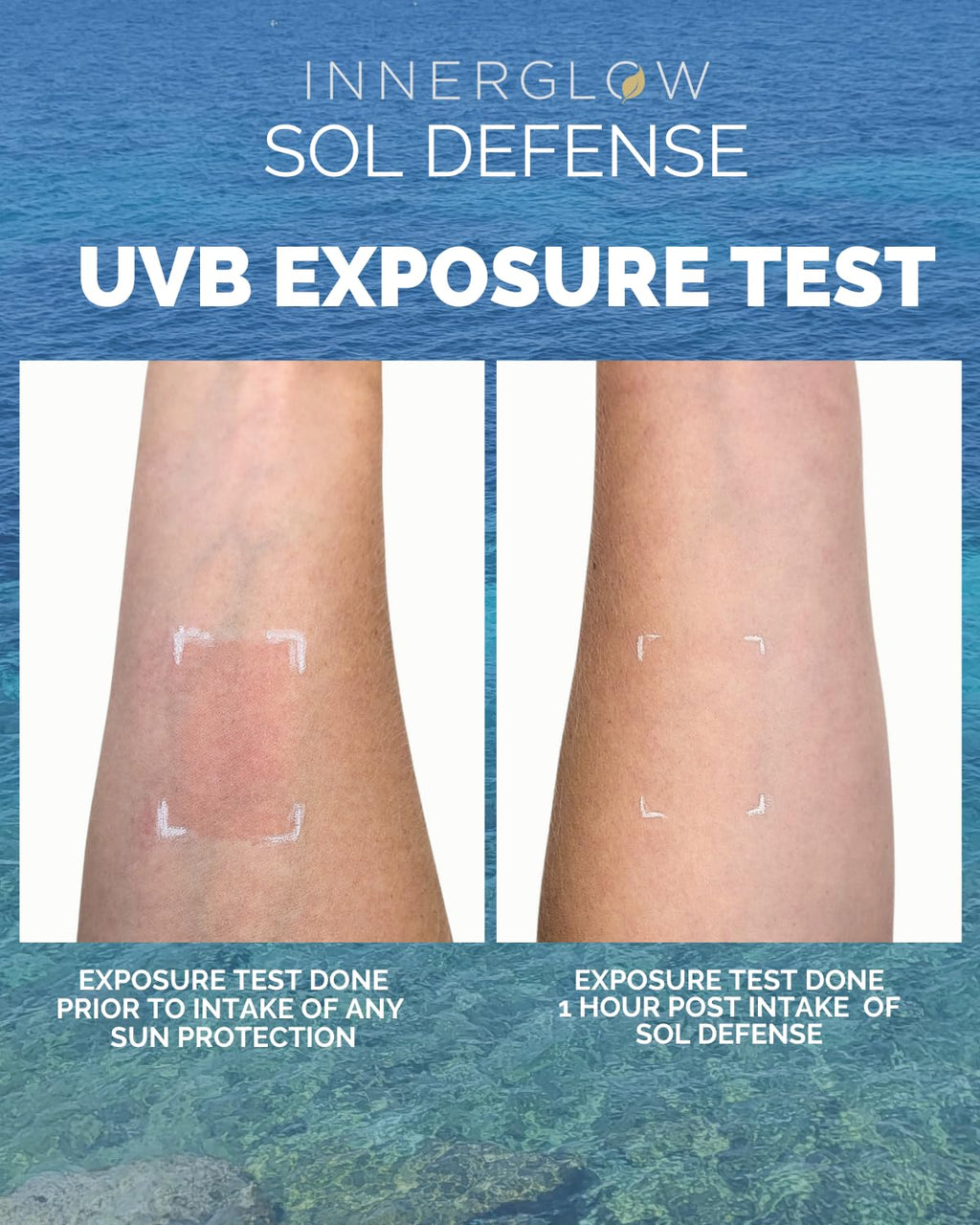Inner Glow Sol Defense Gummies – Dermatologist & Plastic Surgeon-Formulated Skin Resilience Vitamin Supplement with Polypodium Leucotomos & Niacinamide, Passion Fruit Flavor, 60 Sugar-Free Gummies